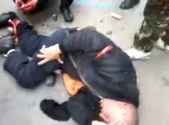 В Одессе боевики-унитаристы отрубили ногу местному жителю (18+) | Русская весна