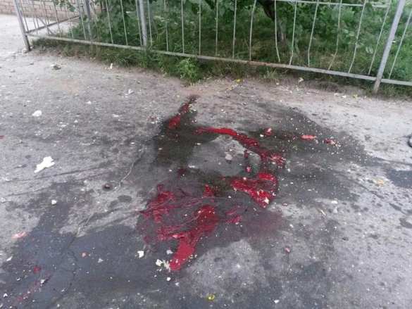 Луганск, улицы залиты кровью, десятки убитых и раненых — материалы для трибунала (фото/видео лента 18+) | Русская весна