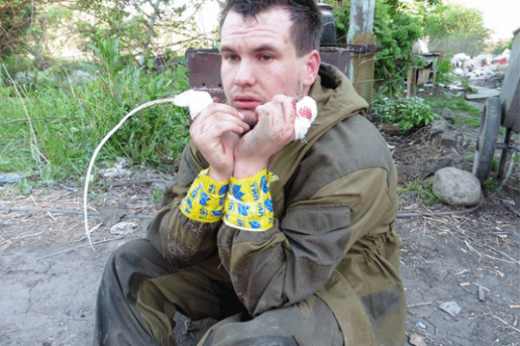 МОЛНИЯ: Пленный ополченец ДНР, которого «Правый сектор» лишил пальцев, обменян | Русская весна