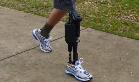 «Киборг» возвращается на Донбасс: убивать врачей, спасших ему ногу (ВИДЕО А. ШАРИЯ) | Русская весна