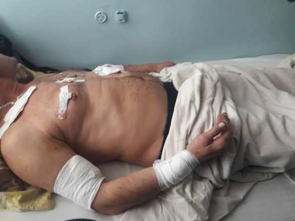 Вводятся категории раненых: Министр обороны поручил усилить поддержку тяжелораненых бойцов СВО (ВИДЕО) | Русская весна