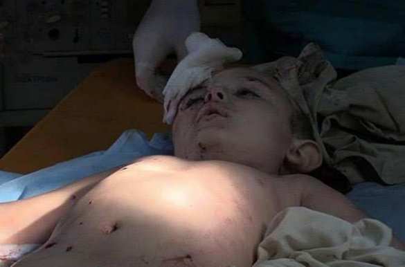 Почему Европа скорбит по сирийскому мальчику-беженцу и равнодушна к гибели его ровесника с Донбасса? | Русская весна