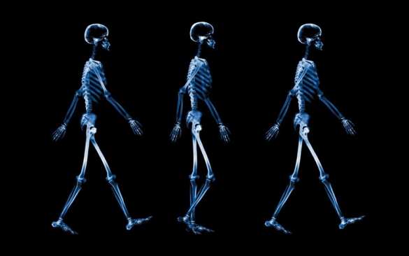 «Флюорография — лженаука»: cоцсети — о новых идеях Минздрава Украины | Русская весна