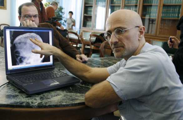 Итальянский нейрохирург заявил об удачной пересадке головы (ВИДЕО) | Русская весна