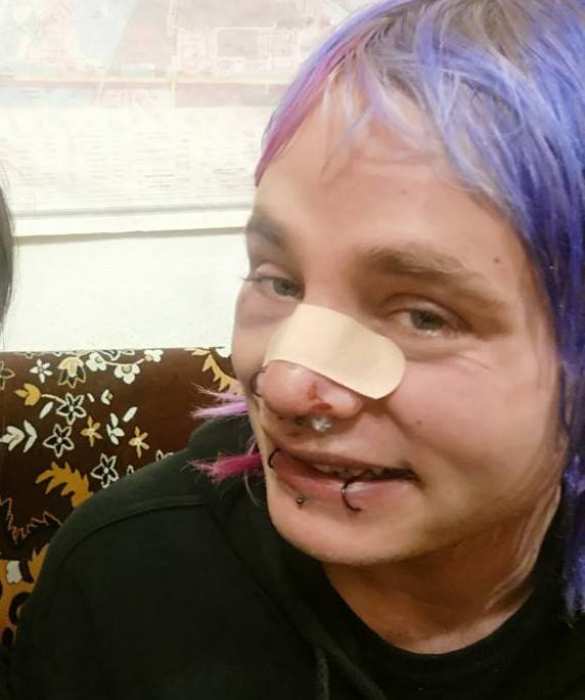 «Такого не было нигде в мире», — британец, жестоко избитый в Киеве (ФОТО) | Русская весна