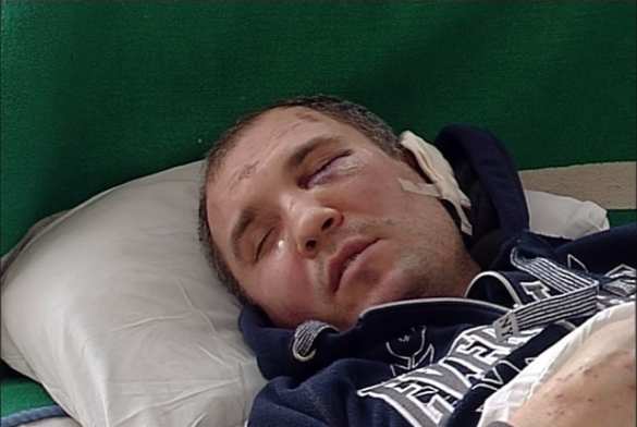 «Гаси эту тварь», — в Черкассах двое полицейских избили мужчину, заступившегося за жену (ФОТО, ВИДЕО) | Русская весна