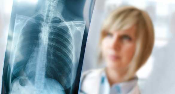 В Германии зафиксировали распространение микоплазменной пневмонии | Русская весна